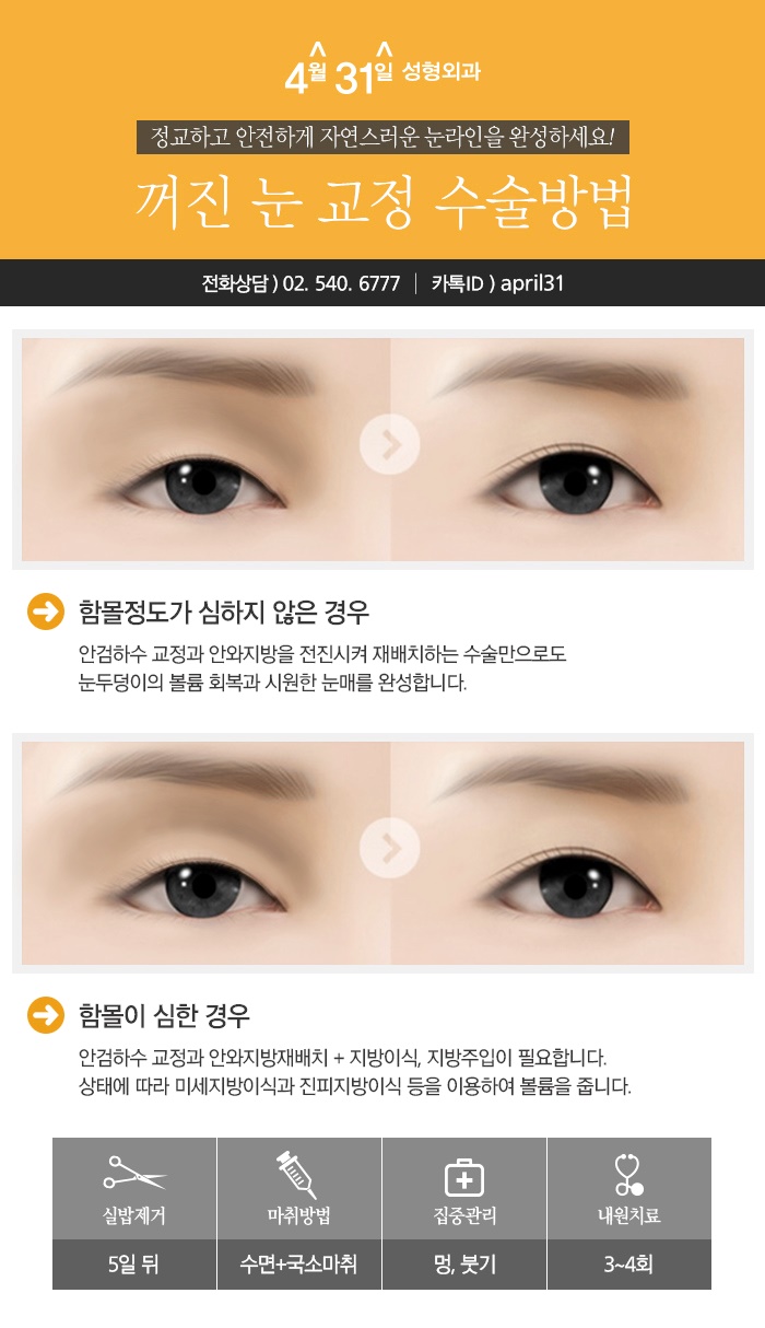 눈지방재배치 알아보자 4월31일성형외과 관련 이미지 5