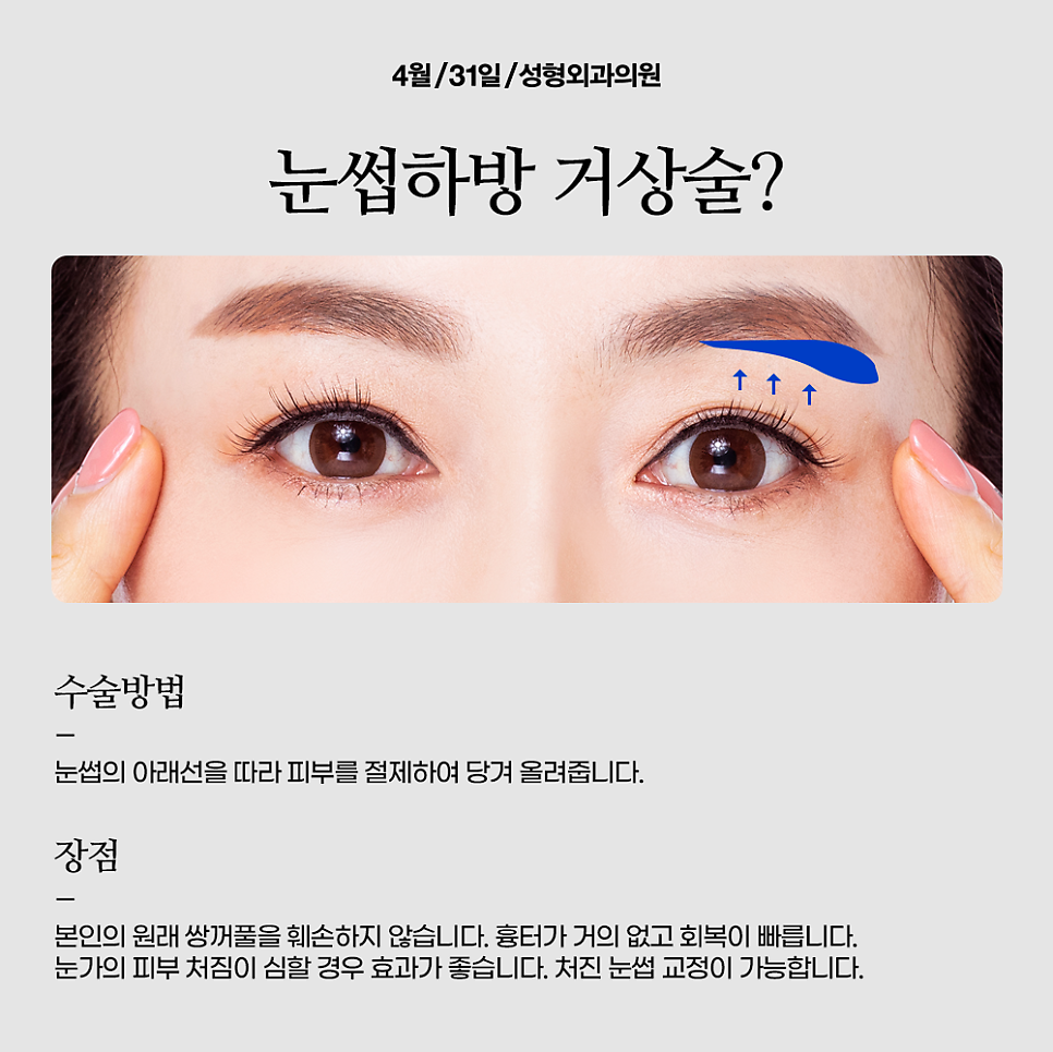 Get a Natural, Youthful Eye Appearance at a Place Skilled in Brow Lift Surgery image 2