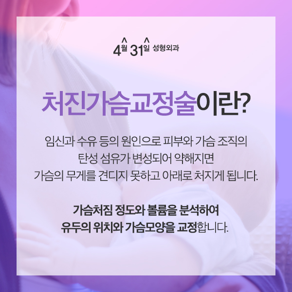 가슴처짐수술 원인에 맞게 4월31일성형외과 관련 이미지 2