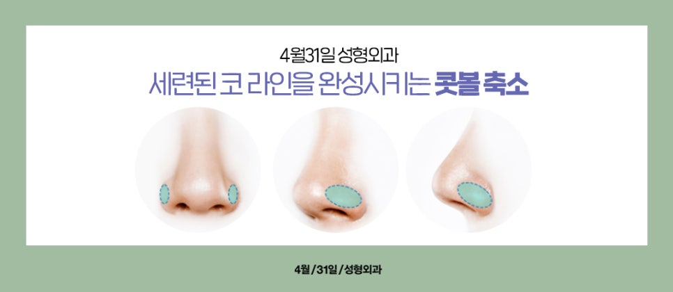 [Nose Surgery] Is It Possible to Reduce a Bulbous Nose with Alar Reduction? Yes or No? image 2