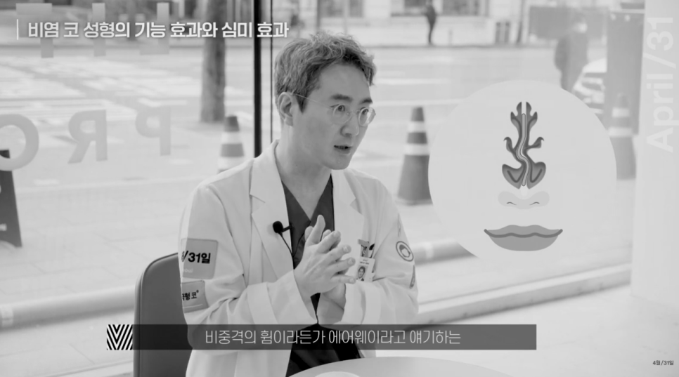 [April 31 Plastic Surgery] Can Rhinoplasty Improve Rhinitis? image 3