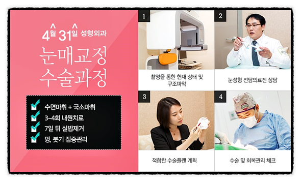 안검하수잘하는병원 찾는다면 4월31일성형외과의원 관련 이미지 3
