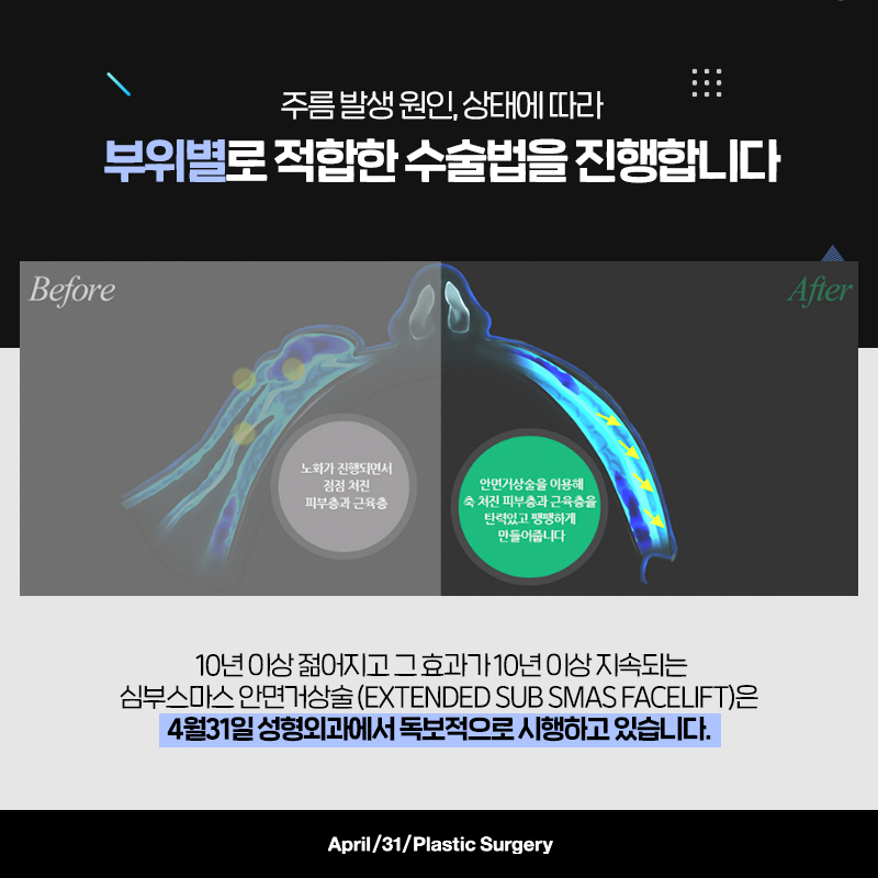 [Facelift] A lifting procedure beyond the limits of non-surgical treatments: 431 Plastic Surgery’s special lifting procedure image 7