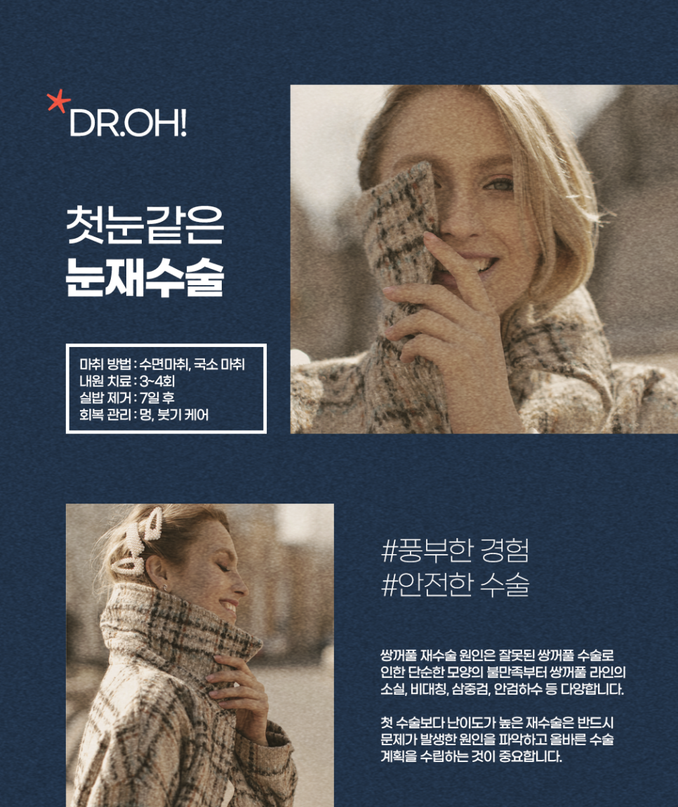 눈재수술잘하는병원 소세지눈, 풀린쌍꺼풀, 짝짝이눈 고민말아요! 관련 이미지 2