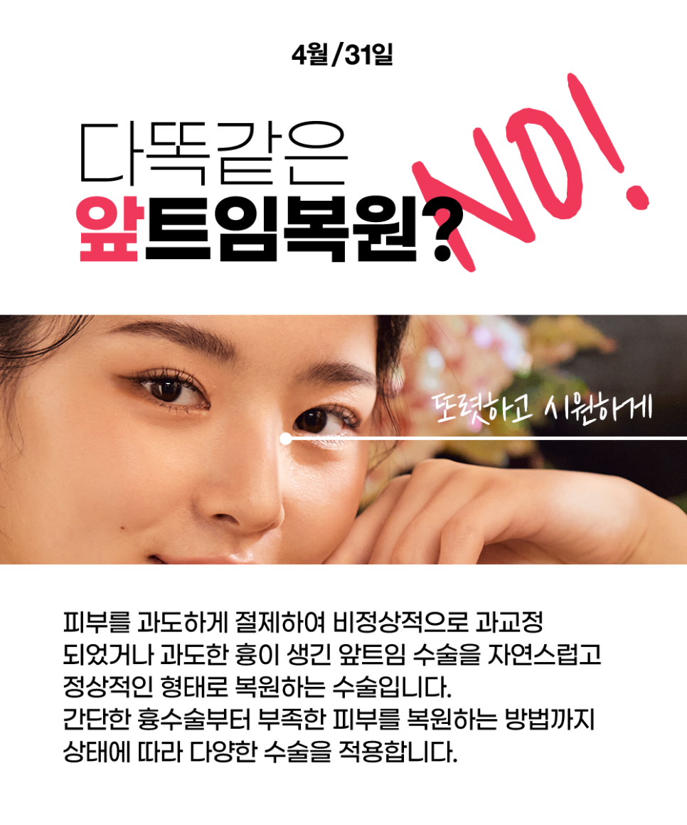 4월31일 Plastic Surgery Clinic: Wrong Epicanthoplasty or Canthoplasty? The Solution Is Right Here! image 2