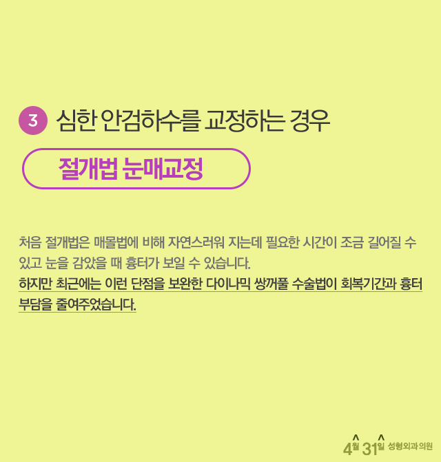 눈성형외과유명한곳 4월31일성형외과의원 관련 이미지 3