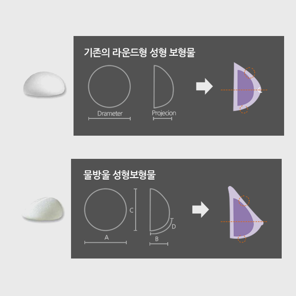 물방울가슴성형촉감 제대로 살려주는 4월31일성형외과 관련 이미지 2