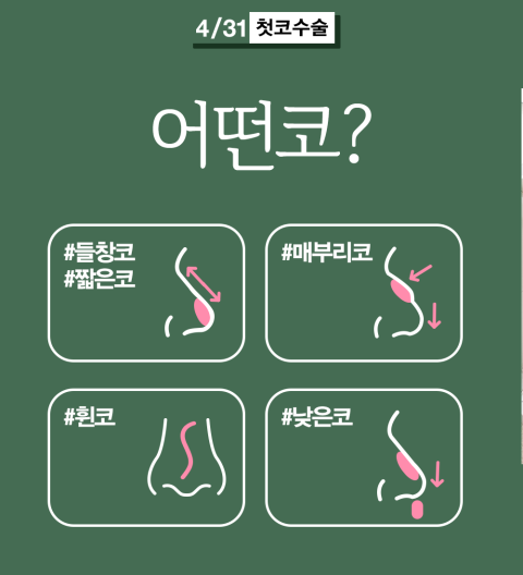 코성형유명한곳 4월31일성형외과&hearts; 관련 이미지 3