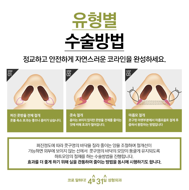 강남콧볼수술후기 하트라인으로 자연스럽게! 관련 이미지 4