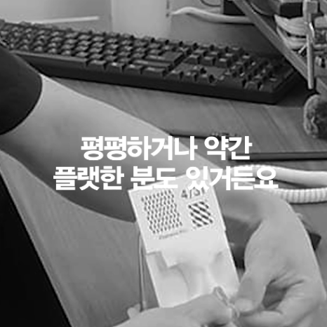 [4월31일성형외과] 코 성형했는데 왜 코끝이 뭉툭해 보일까요? 관련 이미지 8