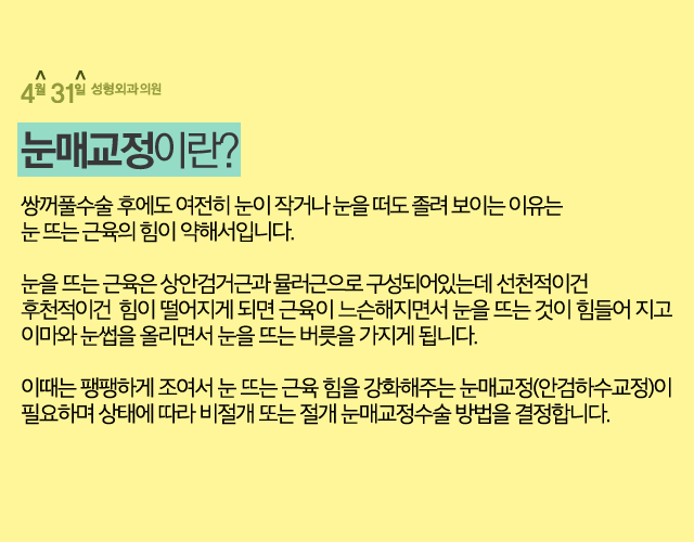 안검하수수술잘하는곳 4월31일성형외과의원 관련 이미지 2
