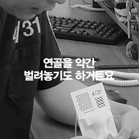 [4월31일성형외과] 코 성형했는데 왜 코끝이 뭉툭해 보일까요? 관련 이미지 15