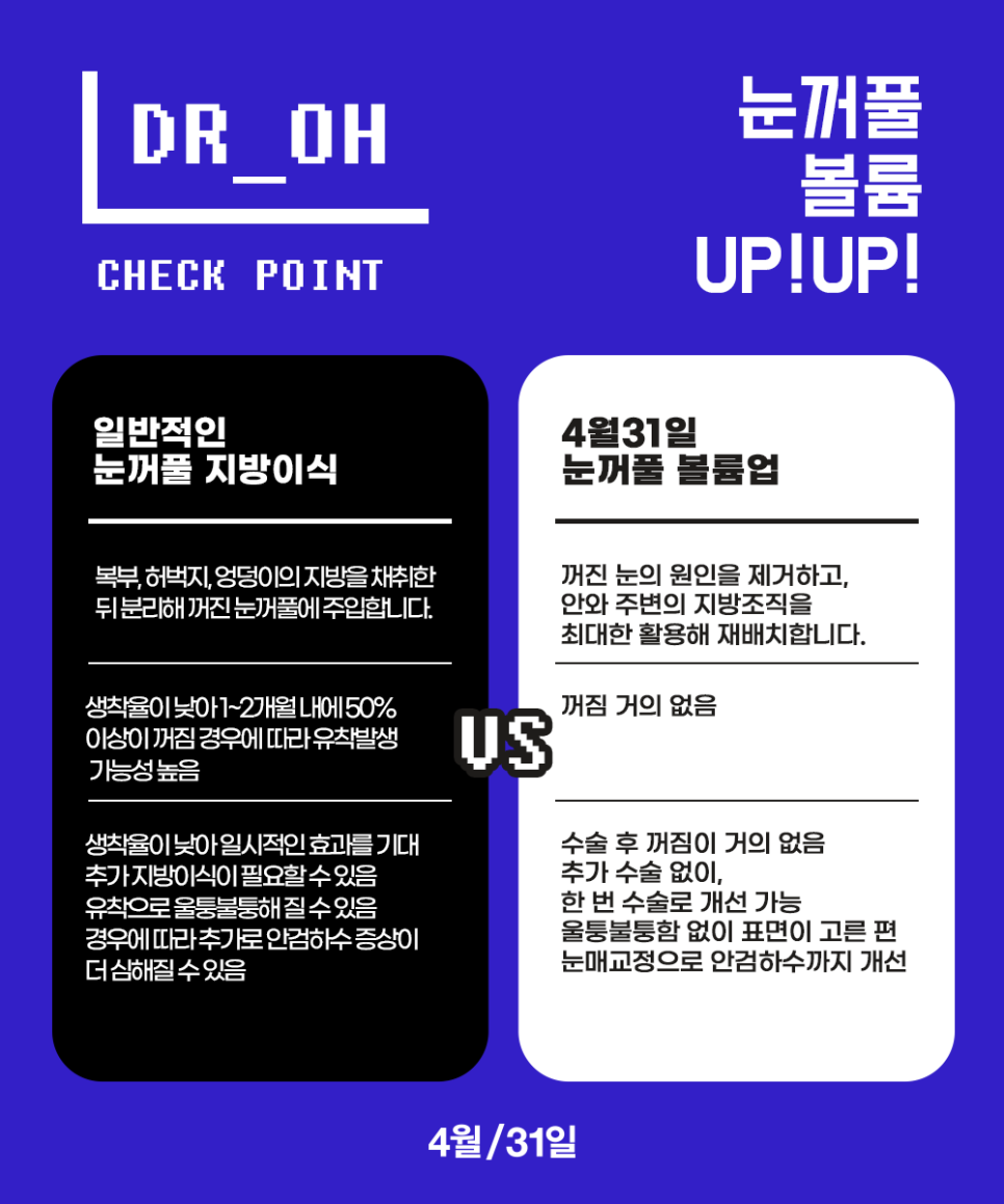 꺼진눈성형비용 시원하고 동안눈매를 원한다면 관련 이미지 2