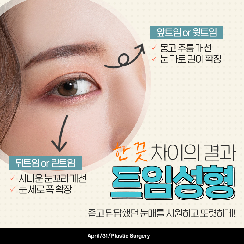 [눈성형] 트임성형의 모든것! 1탄 - 앞트임&윗트임 A-Z 관련 이미지 2