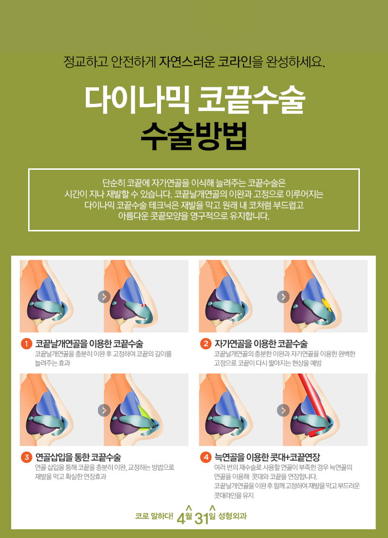 코끝성형부작용 부담 줄여줄 방법은 없는 걸까? 관련 이미지 5