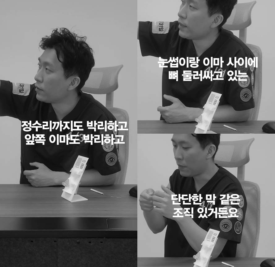 [April 31 Plastic Surgery] How Long Does the Recovery Period for a Forehead Lift Take? image 3