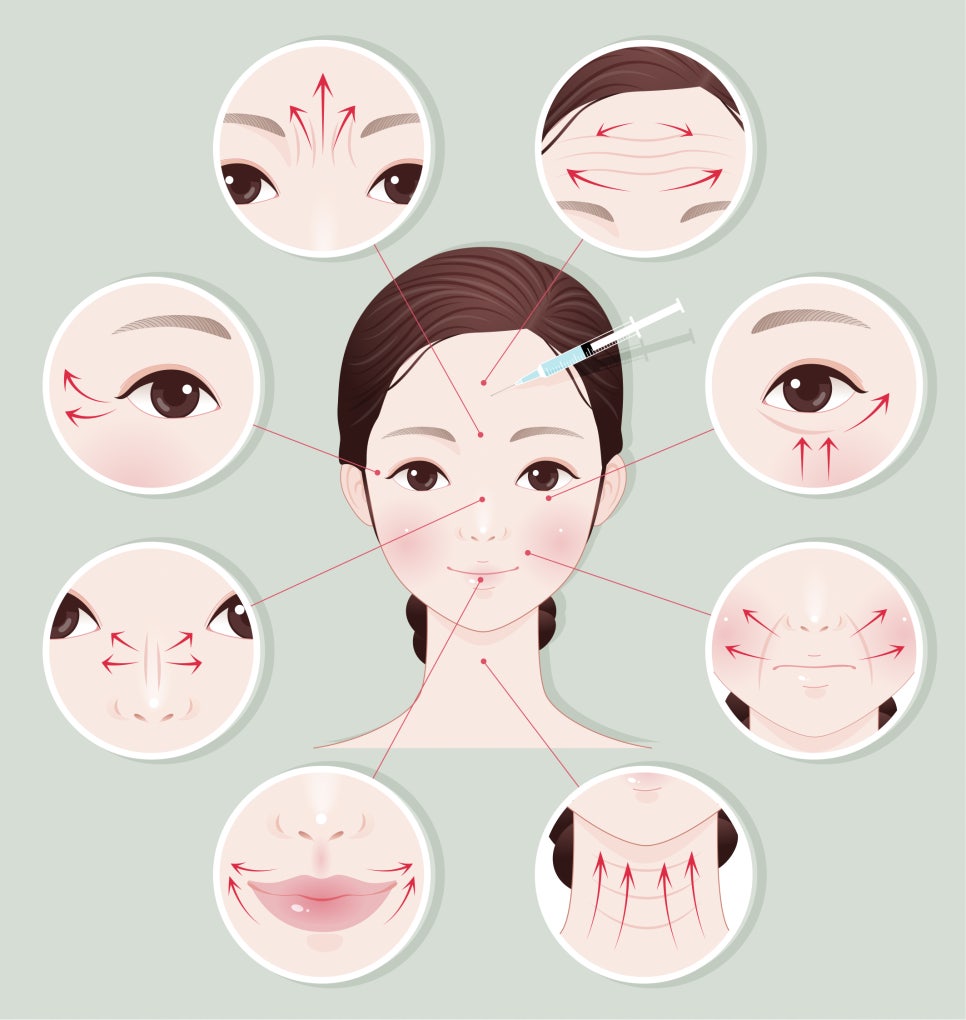 “Botox vs Filler” Complete Guide to Effects, Differences, and Precautions image 3
