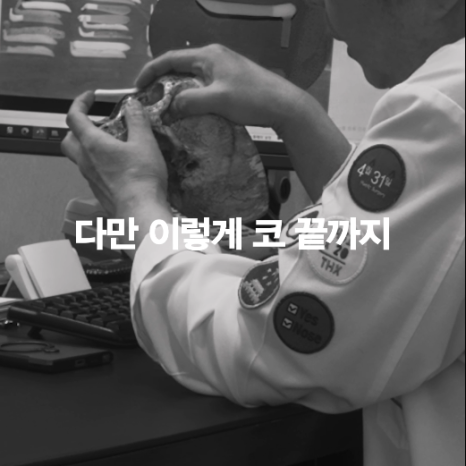 [April 31 Plastic Surgery] The silicone moved after nose surgery! Is that okay? image 6
