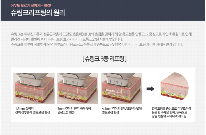 슈링크잘하는곳 4월31일성형외과의 효과 관련 이미지 2
