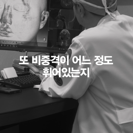 [4월31일성형외과] 코 수술 전 CT 꼭 찍어야 하나요? 관련 이미지 10