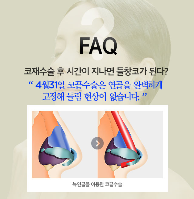 코재수술 믿을 수 있는 4월31일성형외과 관련 이미지 2