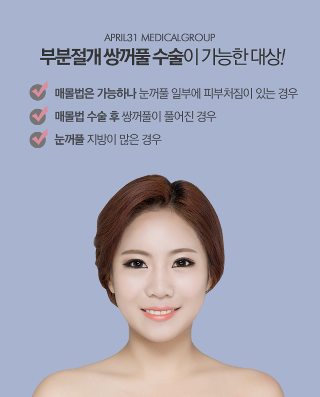 강남쌍꺼풀수술 4월31일성형외과의원이라면 만족 관련 이미지 2