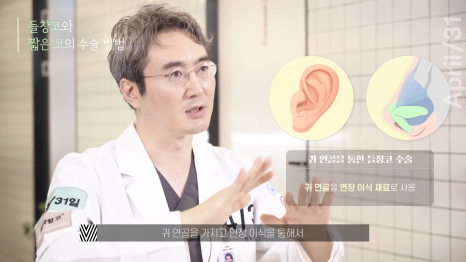 [코성형] 짧은코?들창코? 상태에 따른 수술방법 전격공개! 관련 이미지 8
