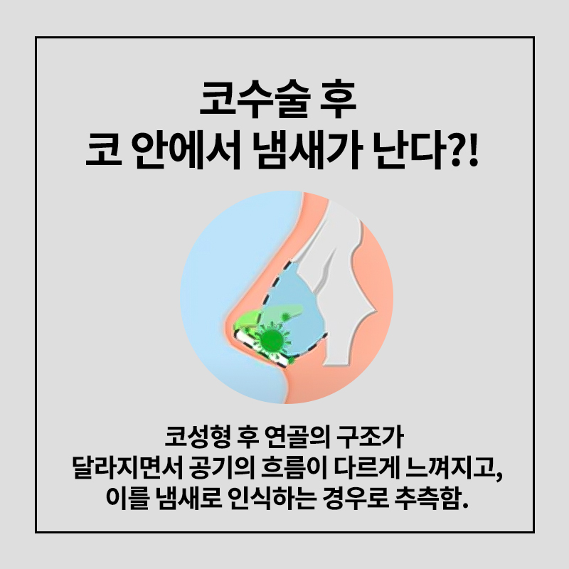 [코성형] 코수술 후 냄새나고, 딱딱 소리가 난다? 관련 이미지 5