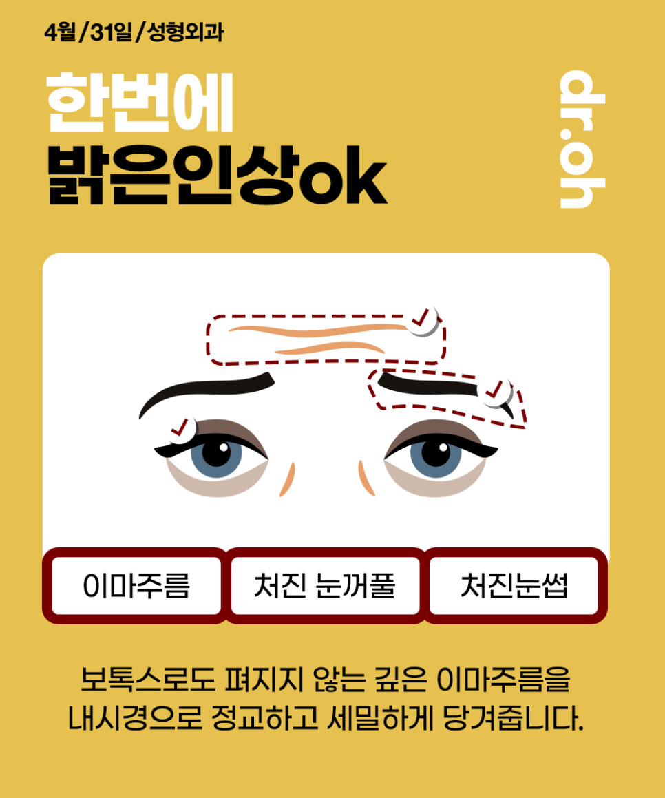 내시경이마거상술잘하는곳 에서 받고 다시 젊은 모습으로 관련 이미지 2