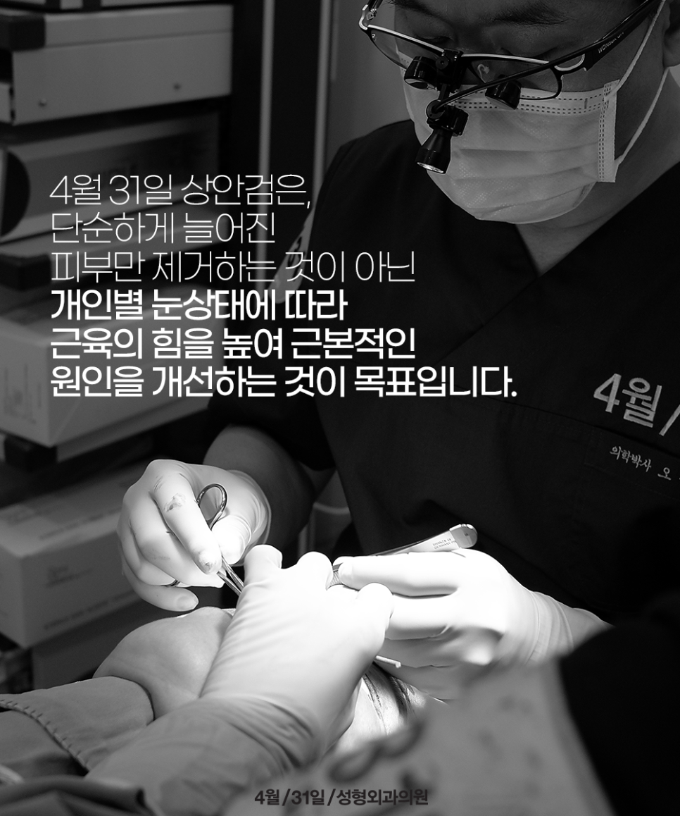 Recommended Middle-Aged Eye Surgery: Upper Blepharoplasty to Make Aging Eyes Look Youthful image 4