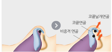 [코성형] 밸런스에 맞는 콧대길이 교정 관련 이미지 4