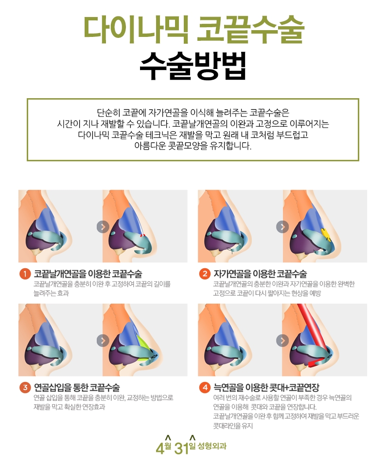 코끝성형후기 꼼꼼하게 따져보기 관련 이미지 4