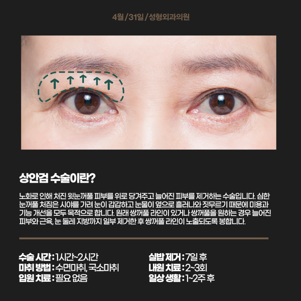 상안검수술잘하는병원에서 동안얼굴을 가져보세요 관련 이미지 2
