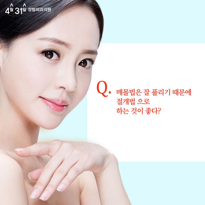매몰법 잘하는병원 4월31일 성형외과의원 관련 이미지 2