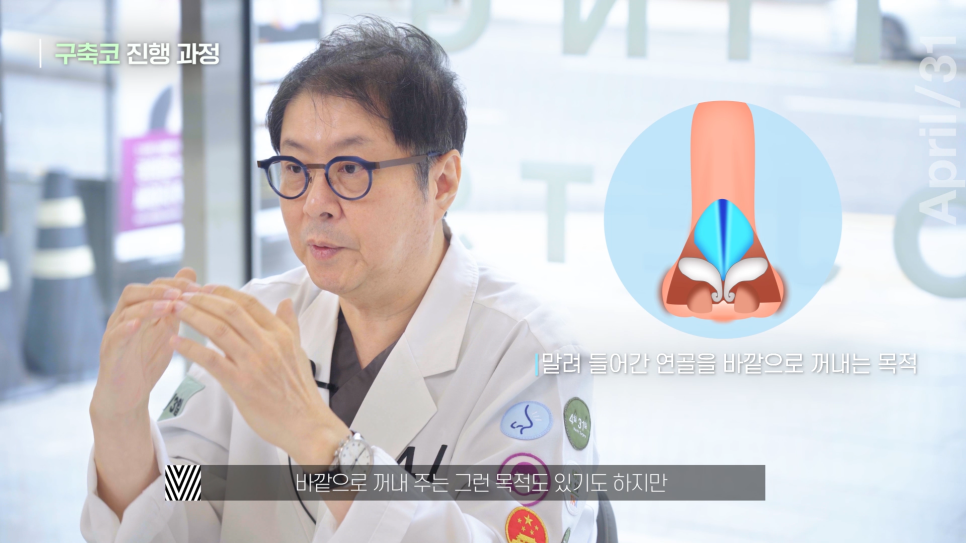 [Contracted Nose] Deep Analysis of the 5 Steps of Contracted Nose Correction Part 02_Separation of the Cartilage Structure and Relocation to the Correct Position image 5