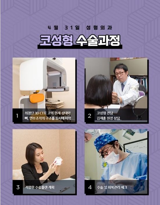 자가조직코성형 4월31일성형외과의원에서 자연스럽게! 관련 이미지 4
