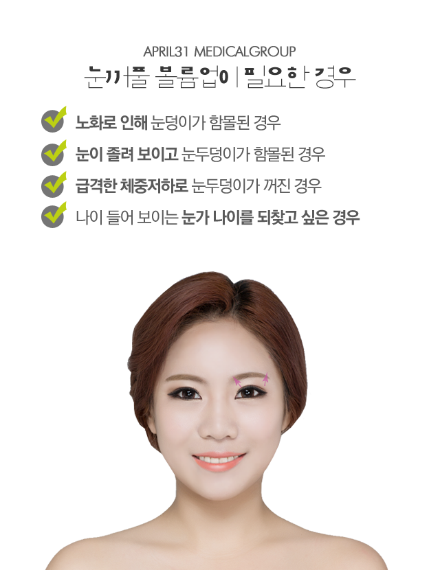 눈꺼풀꺼짐수술 4월31일성형외과의원은 관련 이미지 2