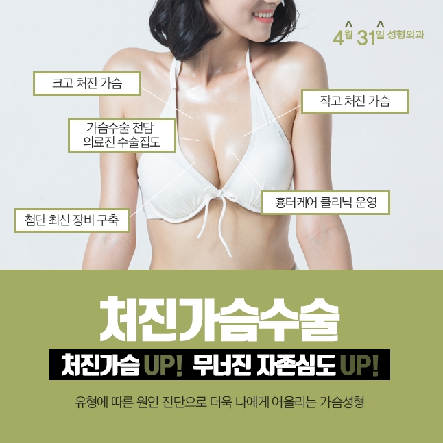 가슴처짐수술후기 4월31일성형외과에서 확인하세요★ 관련 이미지 2