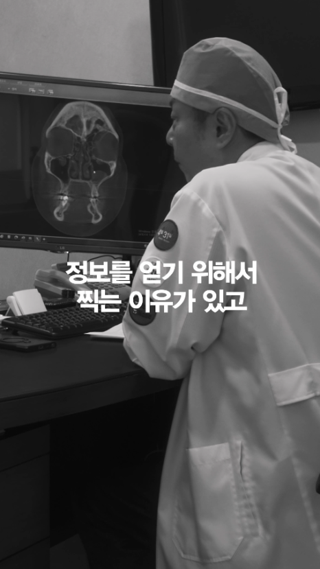 [4월31일성형외과] 코 수술 전 CT 꼭 찍어야 하나요? 관련 이미지 7