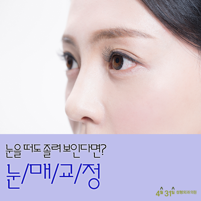 여자눈성형 눈매교정은 4월31일성형외과의원 관련 이미지 1