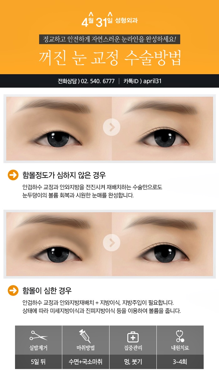 눈꺼풀볼륨업 잘하는곳 4월31일성형외과 관련 이미지 5