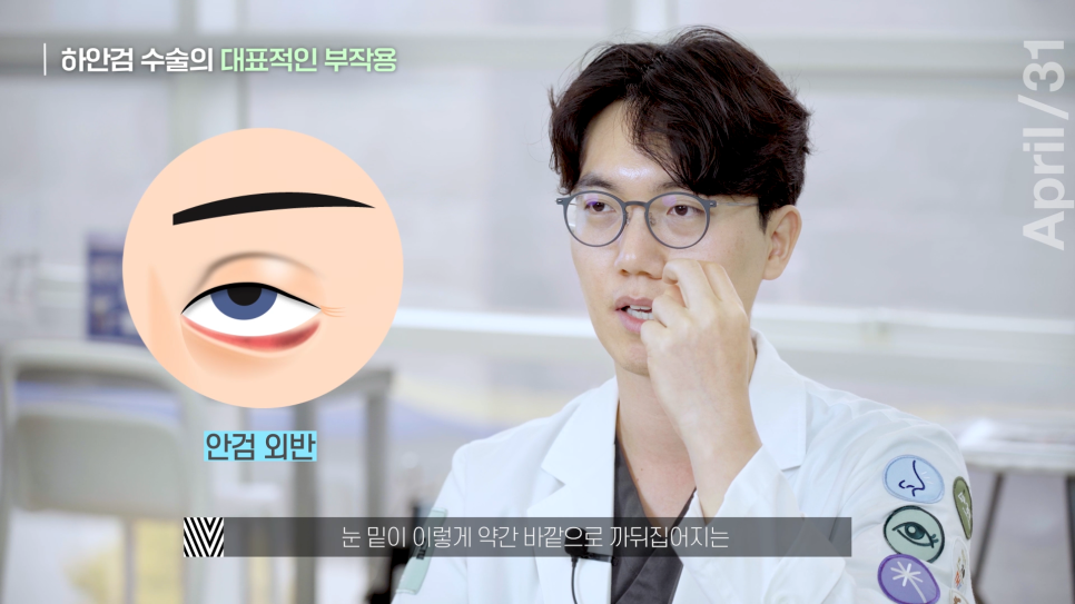 Can You Go Back to Work After Lower Eyelid Fat Repositioning? Yes or No?! (feat. Lower Eyelid Fat Repositioning vs. Lower Blepharoplasty) image 12