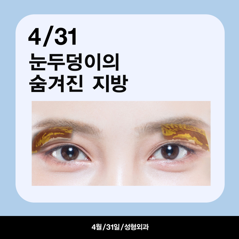 [Eyelid Volume Up] Take Another Look at Sunken Eyes! Eyelid Volume Up Surgery image 2