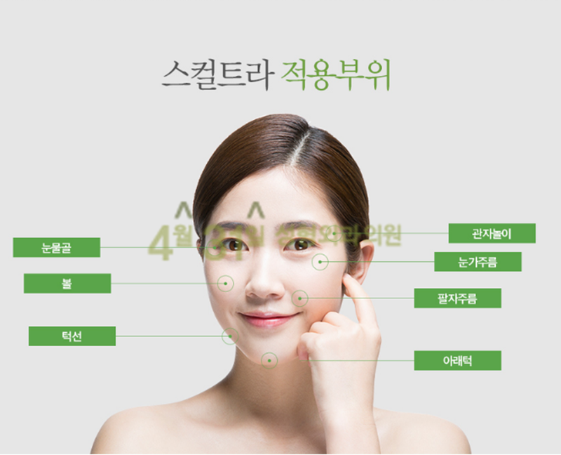 스컬트라필러효과 일반 필러랑 뭐가 다를까? 관련 이미지 4