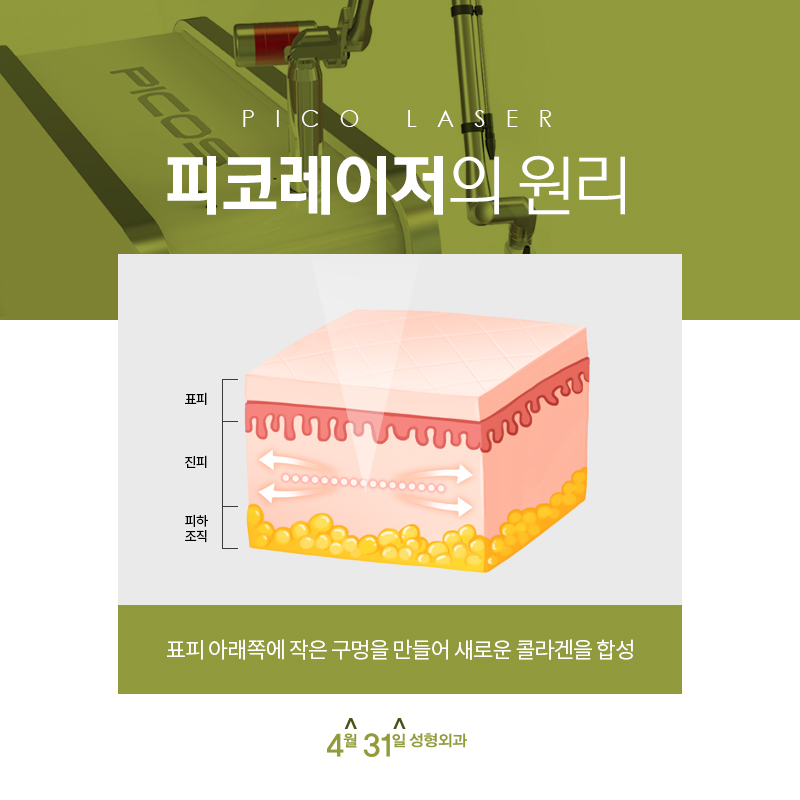 나비존 조여주는 모공축소레이저를 선택한다면? 관련 이미지 8