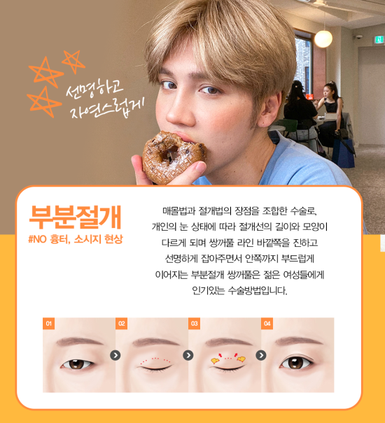 쌍꺼풀잘하는병원 학동역 4월31일성형외과 관련 이미지 3
