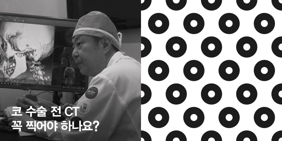 [4월31일성형외과] 코 수술 전 CT 꼭 찍어야 하나요? 관련 이미지 1