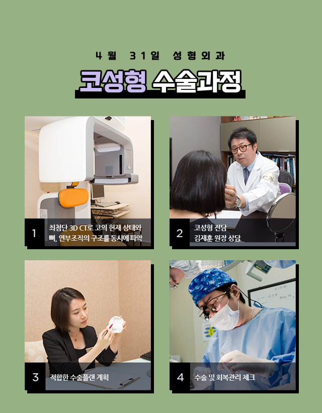 매부리코수술잘하는병원 고민하고 계신가요? 관련 이미지 8