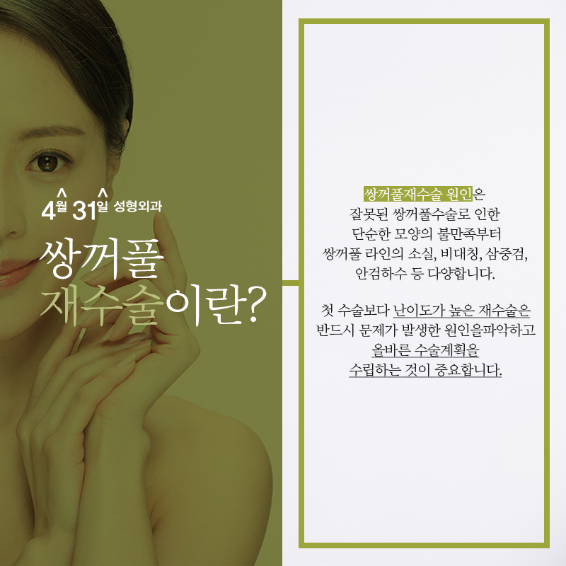 쌍꺼풀재수술가격 적당한곳이란 관련 이미지 2