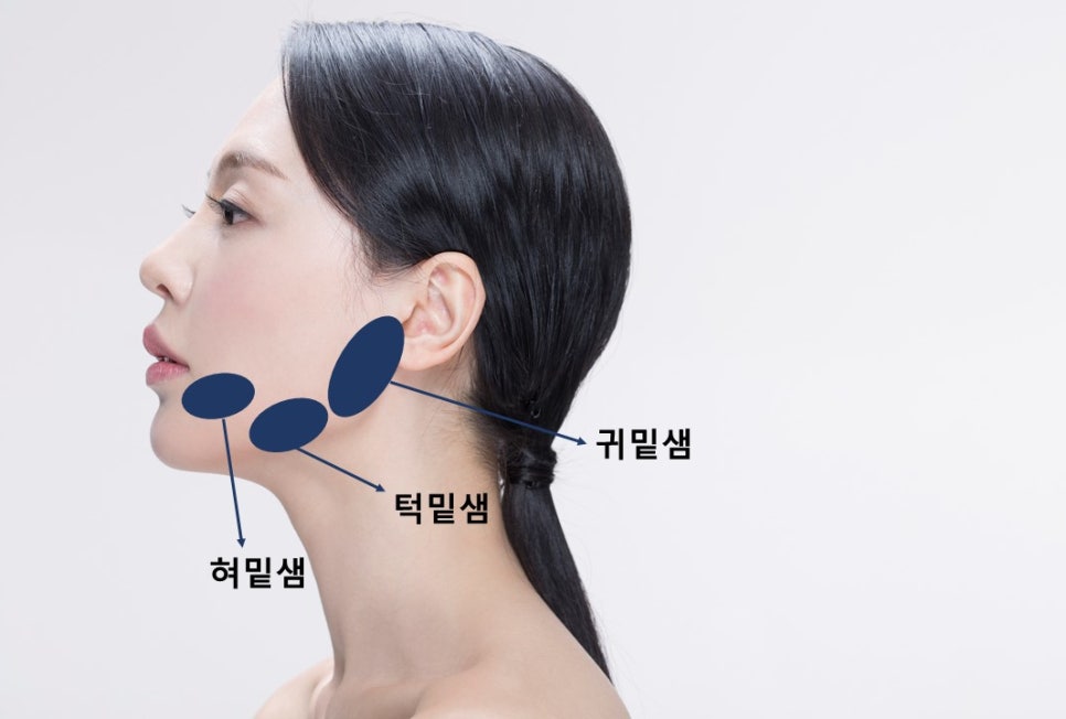 [April 31 Petit Center] What Causes a Square Jaw That Contour Injections Can’t Fix? (feat. Salivary Gland Botox) image 2